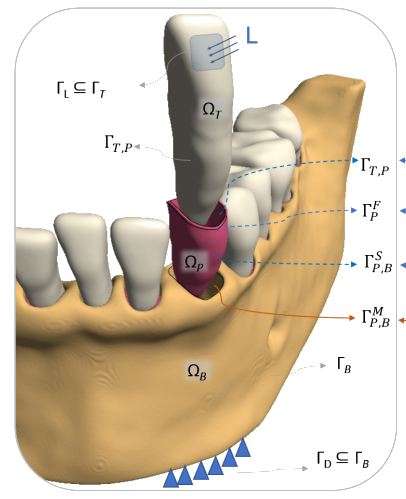 jaw_sim_setup.png