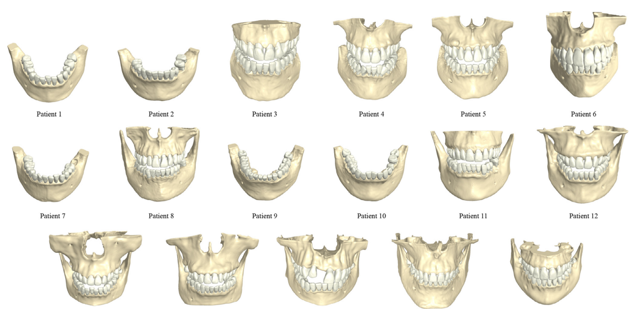 Jaws Anatomy